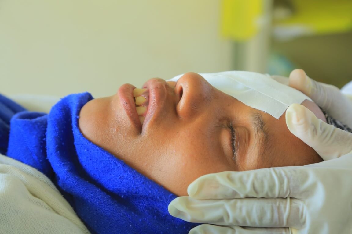 Junge Äthiopierin nach einer Operation am Augenlid